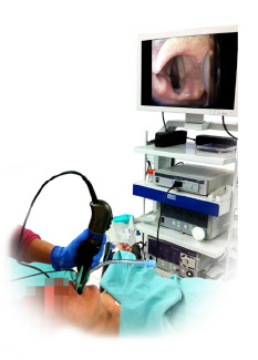 Endo Cam