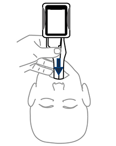 Slide midline around the tongue
