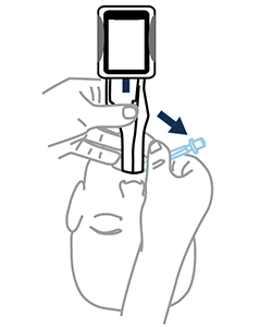 Remove midline