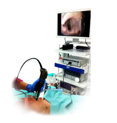 Endo Cams