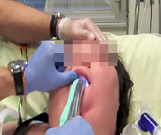Airtraq Face to Face Intubation